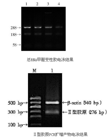 电泳结果